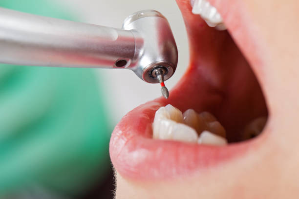 Best Emergency Treatment for Dental Infections or Abscesses in Cedar Glen Lakes, NJ